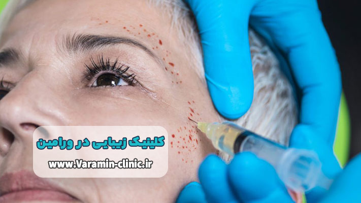 خدمات پی آر پی در کلینیک زیبایی ورامین